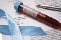 Blutabnahmeröhrchen für Bestimmung des PSA Wertes liegt auf Untersuchungsbogen neben hellblauer Schleife